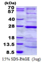 Human HRPAP20 protein, His tag