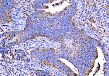 Anti-NTN3 Antibody 抗体，orb17861