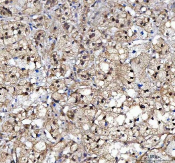 Anti-CBP20/NCBP2 Antibody 抗体，o