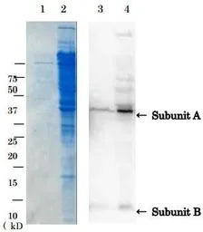 Verotoxin / Shiga toxin (SLT-1