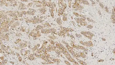 E-Cadherin antibody [36B5]