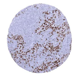 Factor XIIIa antibody [MSVA-81