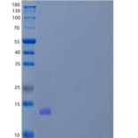 人转化酶枯草杆菌蛋白酶/Kexin 9型/PCSK9重组蛋白C-6His/HA/AVI