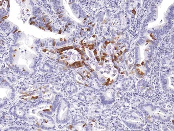 Mucin 5AC antibody [IHC625]