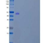 人可能的丝氨酸羧肽酶CPVL/VCP样重组蛋白C-6His