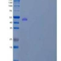 人可能的丝氨酸羧肽酶CPVL/VCP样重组蛋白C-6His