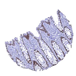 SATB2 antibody [MSVA-702R] His