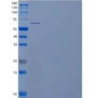 人含缬酪肽蛋白(VCP)重组蛋白C-6His