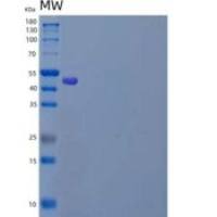 人自噬相关4同源物A/ATG4A重组蛋白N-6His
