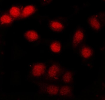 Anti-CBP20/NCBP2 Antibody 抗体，o