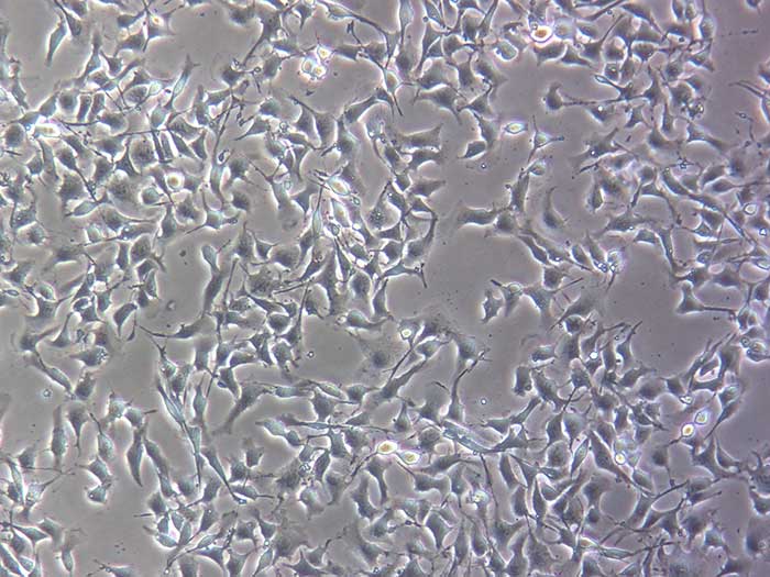 B16F10细胞图片