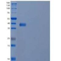 人细胞色素b-c1复合物亚单位6/UQCRH重组蛋白N-GST