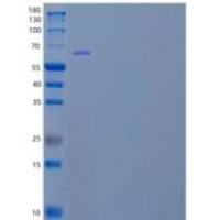 人X-脯氨酰氨肽酶3(XPNPEP3)重组蛋白N, C-6His