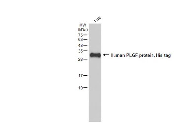 Human PLGF protein, His tag