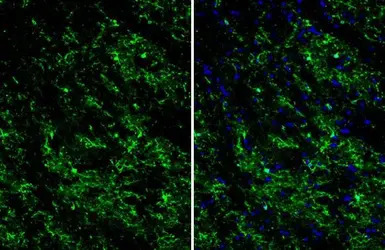 TMEM119 antibody [HL2415]