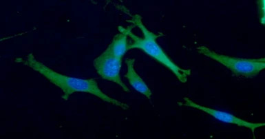 Aldolase C antibody [AT2E11]
