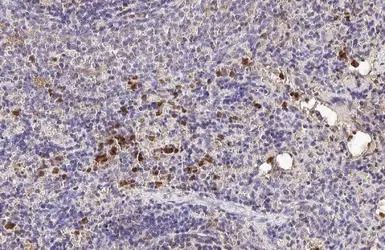 Hemoglobin epsilon antibody [H