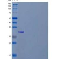 人ZW10交互器/ZWINT重组蛋白N-6His