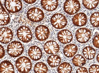 LI-Cadherin antibody [029]