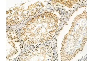 Ki67 (phospho Thr1335) antibod