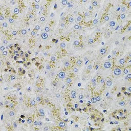 alanyl-tRNA synthetase antibod