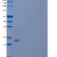 人视蛋白样蛋白1/VILIP/VSNL1重组蛋白N-6His