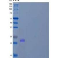 人Z-DNA结合蛋白1(ZBP1)重组蛋白C-6His