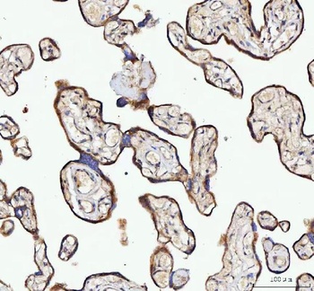 Anti-NUBPL Antibody 抗体，orb1786