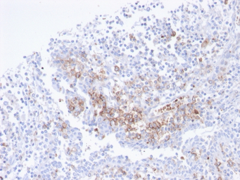 CD38 antibody [CD38/4247R]