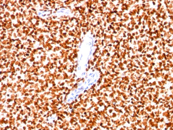 Nkx2.2 antibody [SPM564]