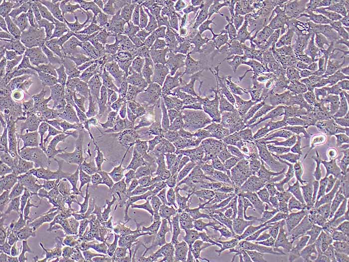 Hep3B2.1-7细胞图片