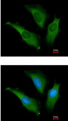Rabbit anti Human HSP70 Polycl
