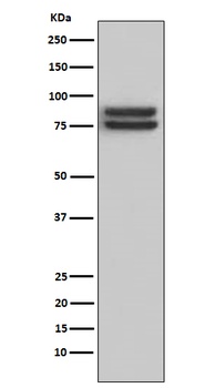 FOXP1 Monoclonal Antibody 抗体，o