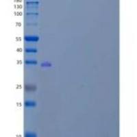 人胞质磺基转移酶家族1A成员1重组蛋白