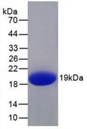 Human IL1F9 protein, His tag