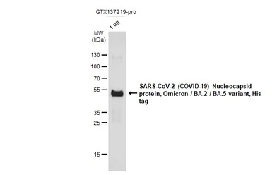 SARS-CoV-2 (COVID-19) Nucleoca