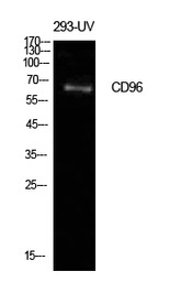 CD96 antibody