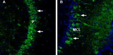 NCAM2 antibody
