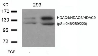 HDAC4 (phospho Ser246) + HDAC5