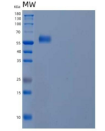 人泛素关联蛋白1/NAG20(UBAP1)重组蛋白C-6Hi