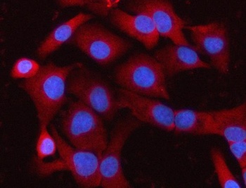 Anti-MELK Antibody 抗体，orb17860