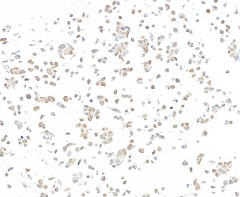 p16INK4a Antibody 抗体，orb180643