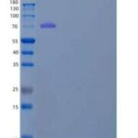 人X-脯氨酰氨肽酶1(XPNPEP1)重组蛋白C-6His
