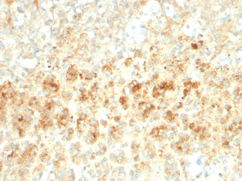 ADFP antibody [ADFP/2755R]