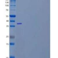 人醛酮还原酶1C4/AKR1C4重组蛋白N-6His