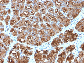 MUC1 antibody [MUC1/2818R]
