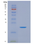 人白介素1家族成员9(IL1F9)重组蛋白