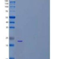 人LAIR-1/CD305重组蛋白C-6His