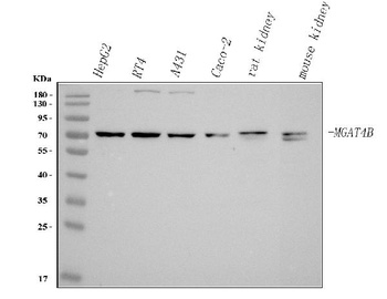 Anti-MGAT4B Antibody 抗体，orb174