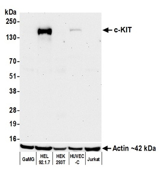 c-Kit Antibody 抗体，orb1733238，B